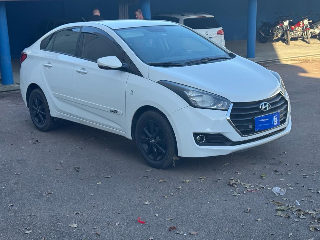 Hyundai Hb20S 2018