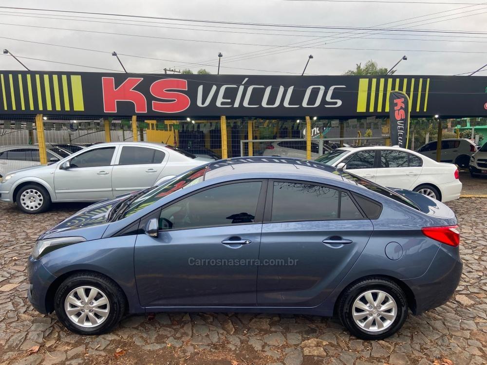 Hyundai Hb20s